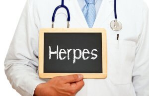Herpes zoster liječenje