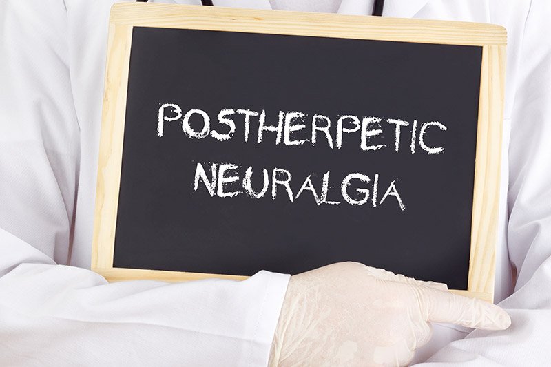 Postherpetična neuralgija